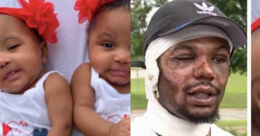 Ήρωας πατέρας ρίχτηκε στις φλόγες και έσωσε τις δίδυμες κορούλες του από βέβαιο θάνατο