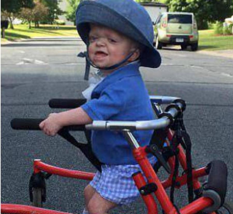 Γιαγιά 58 ετών υιοθετεί δίδυμα με σπάνια γενετική παραμόρφωση και αφιερώνει τη ζωή της ώστε να κάνει τη δική τους καλύτερη