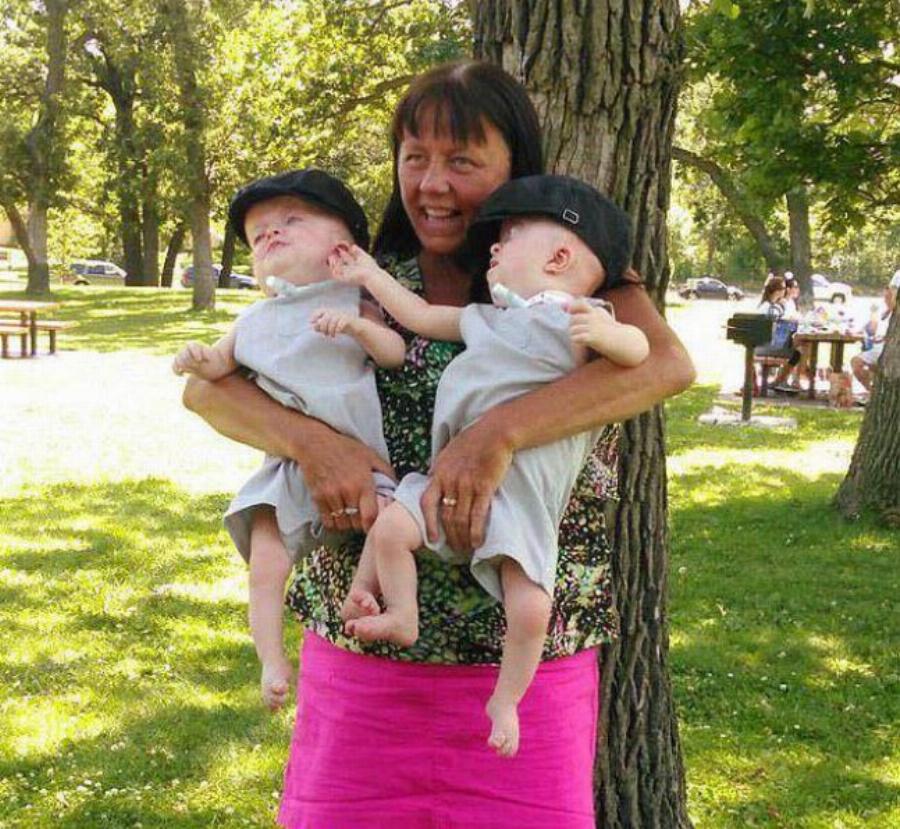 Γιαγιά 58 ετών υιοθετεί δίδυμα με σπάνια γενετική παραμόρφωση και αφιερώνει τη ζωή της ώστε να κάνει τη δική τους καλύτερη