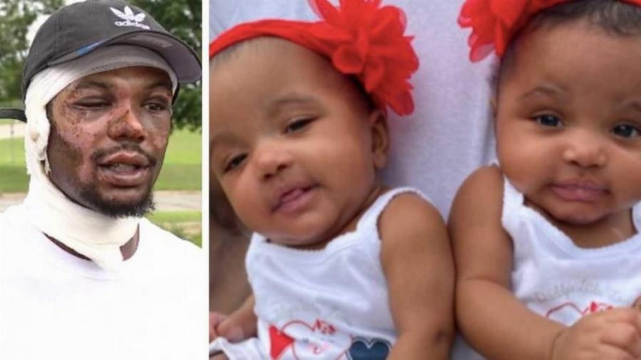 Ήρωας πατέρας ρίχτηκε στις φλόγες και έσωσε τις δίδυμες κορούλες του από βέβαιο θάνατο