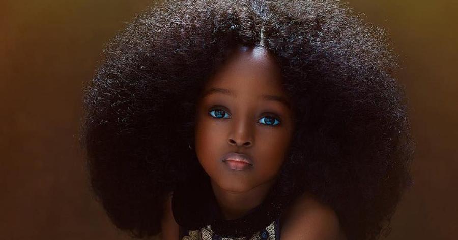 «Το ωραιότερο κορίτσι στον κόσμο»: Η 5χρονη από τη Νιγηρία με το αγγελικό πρόσωπο