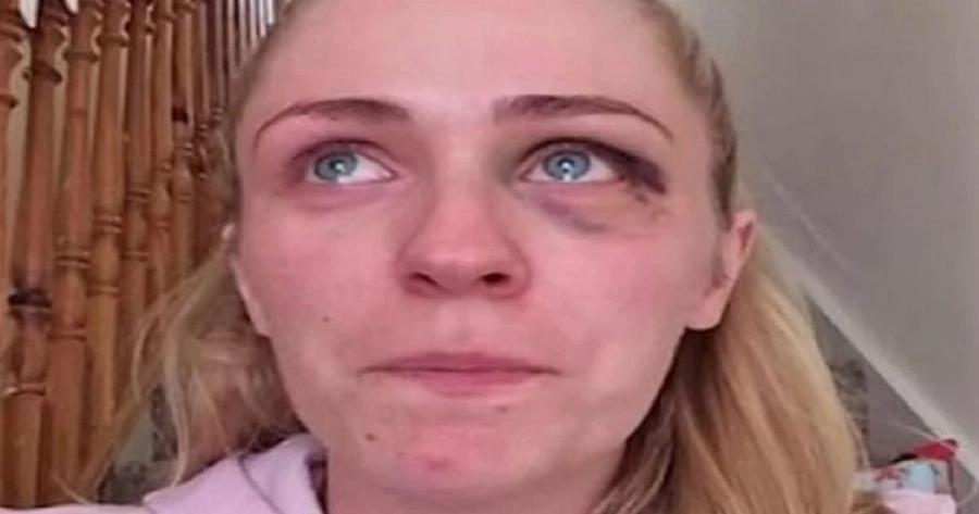 Αν βλέπατε την αδερφή σας ή την κόρη σας με μαυρισμένο μάτι από τον γαμπρό… τι θα κάνατε;