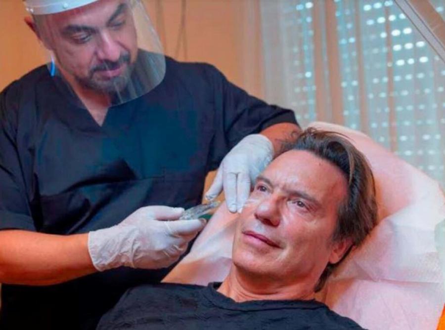 Τέσσερις διάσημοι Έλληνες άντρες που παραδέχτηκαν πως έχουν κάνει μπότοξ