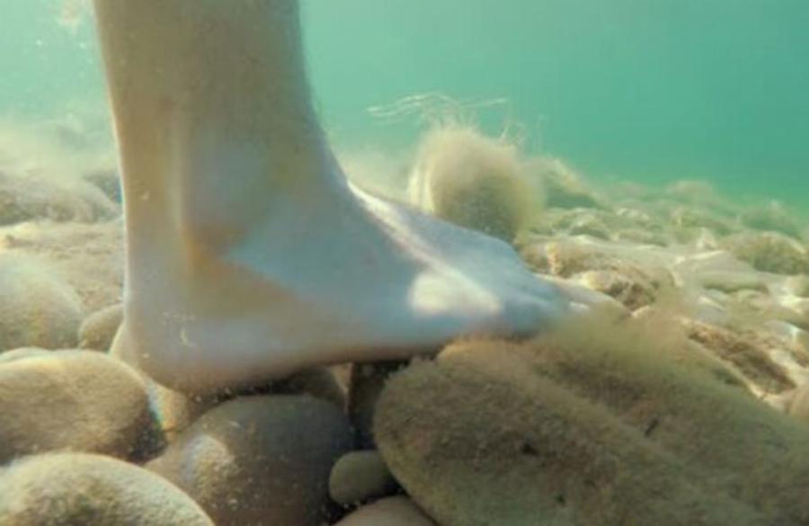 Όλα όσα πρέπει να κάνεις, αν τραυματιστείς με αχινό, δράκαινα, τενεκεδάκι ή γυαλί στην παραλία