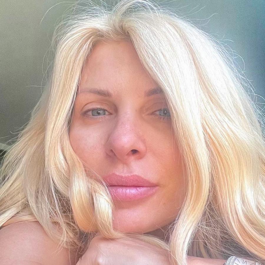 Χωρίς ίχνος μακιγιάζ: 10 διάσημες που είναι ομορφότερες άβαφες και φυσικές