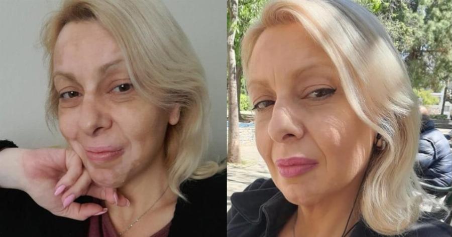 Πάλευα με λεύκη και καρκίνο ενώ μεγάλωνα μόνη 4 παιδιά. Ώσπου έβγαλα τα «σκουπίδια» από τη ζωή μου