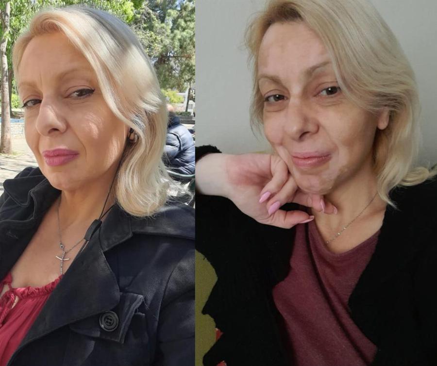 Πάλευα με λεύκη και καρκίνο ενώ μεγάλωνα μόνη 4 παιδιά. Ώσπου έβγαλα τα «σκουπίδια» από τη ζωή μου