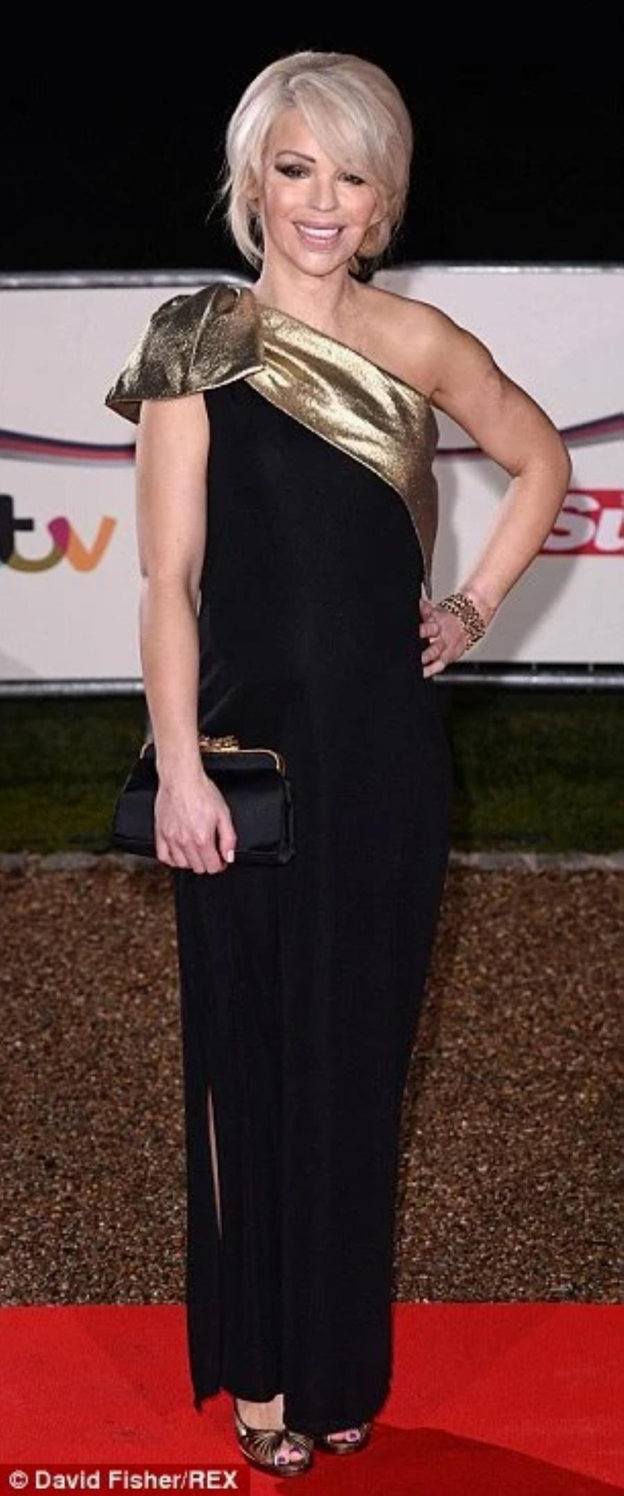 Αληθινή ηρωίδα: Της έριξαν βιτριόλι στο πρόσωπο, την κακοποίησαν,  και σήμερα είναι γνωστή παρουσιάστρια στην τηλεόραση