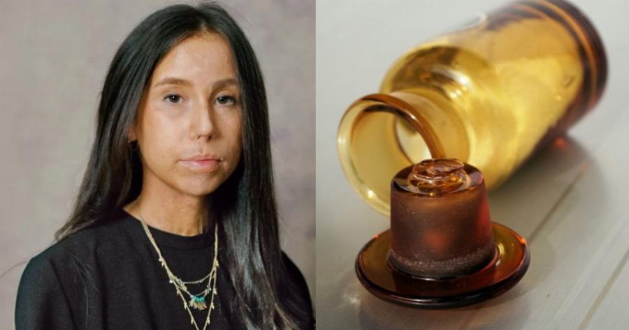 Αληθινή ιστορία της Άννας: «Μου έριξαν βιτριόλι στο πρόσωπο επειδή είχα σχέση με παντρεμένο. Το έκαναν η σύζυγός του με τη κουμπάρα της»