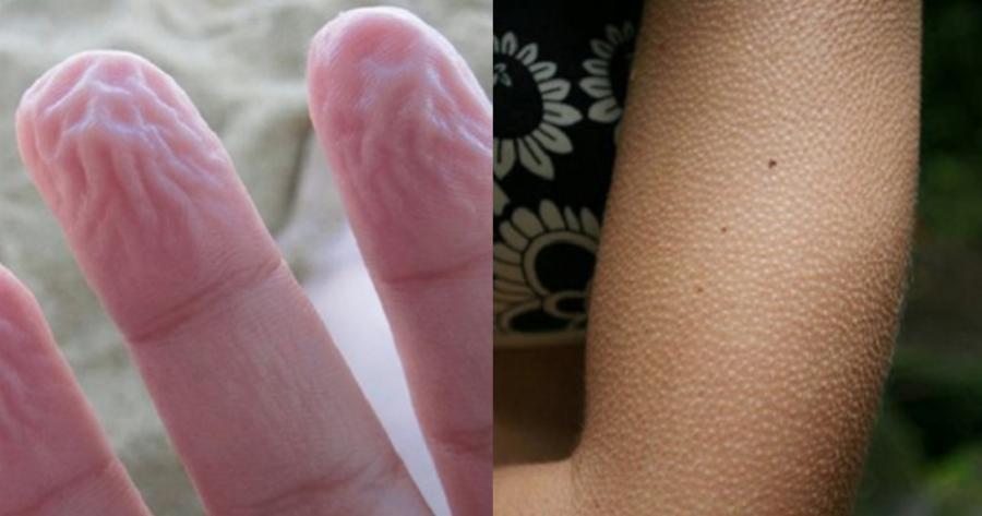 Εννιά παράξενα πράγματα που κάνει ως άμυνα το σώμα μας και δεν τα γνωρίζαμε