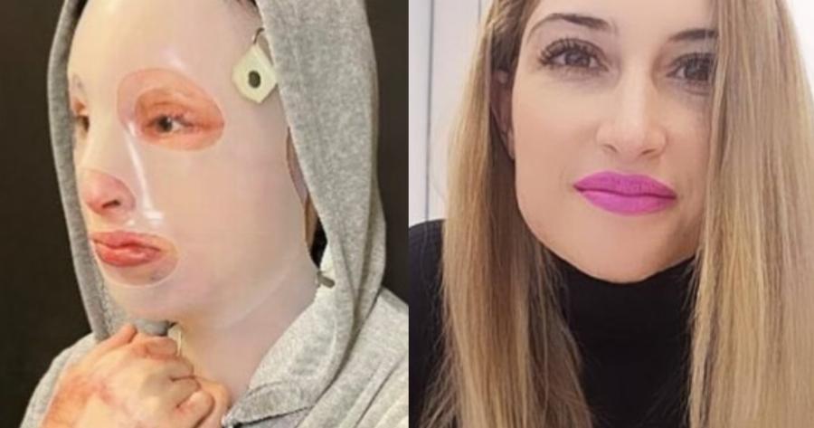 Η πρώτη συνάντηση της Ιωάννας με την 36χρονη που της έριξε το βιτριόλι