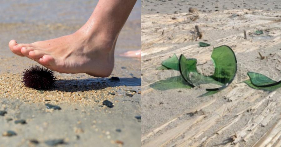 Όλα όσα πρέπει να κάνεις, αν τραυματιστείς με αχινό, δράκαινα, τενεκεδάκι ή γυαλί στην παραλία