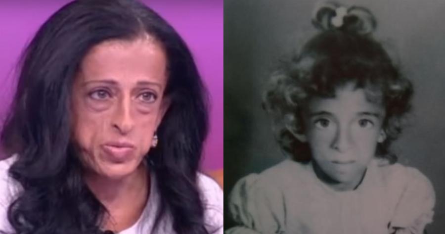 Αφοπλιστική η Μαρία Λοΐζου: «Σε ηλικία 14 ετών, με έλεγαν πίθηκο. Με ρωτούσαν γιατί γεννήθηκα έτσι»