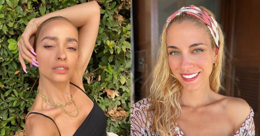 Έκαναν πλαστική και δεν το κρύβουν: 6 Ελληνίδες που επισκέφτηκαν τον πλαστικό χειρούργο