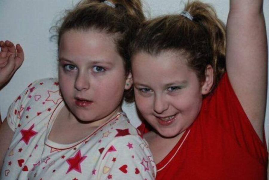 Ήταν τα δίδυμα “Ασχημόπαπα” – Τελικά έγιναν διάσημες και βασίλισσες της ομορφιάς