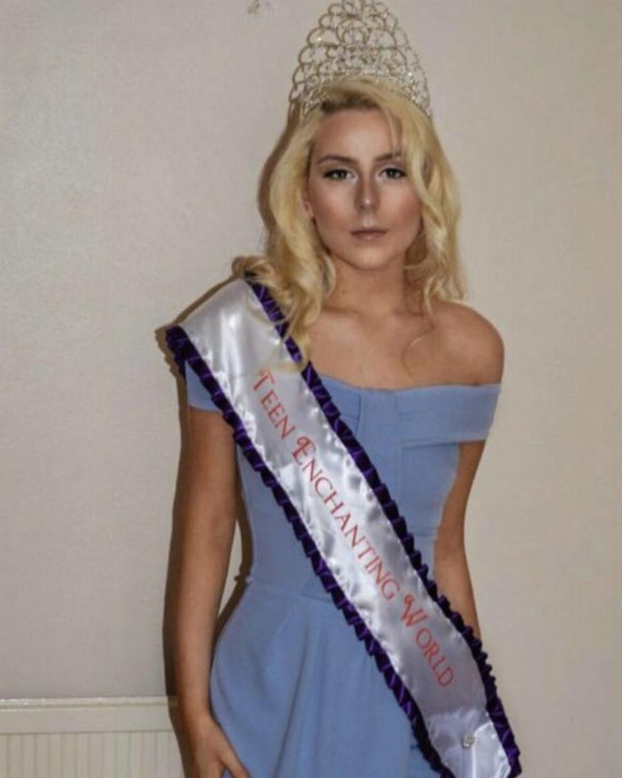 Ήταν τα δίδυμα “Ασχημόπαπα” – Τελικά έγιναν διάσημες και βασίλισσες της ομορφιάς