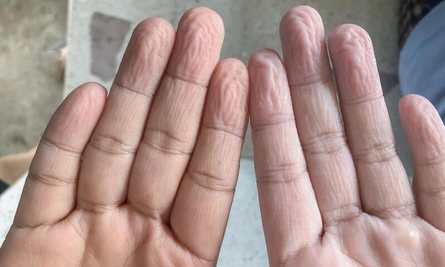 Εννιά παράξενα πράγματα που κάνει ως άμυνα το σώμα μας και δεν τα γνωρίζαμε