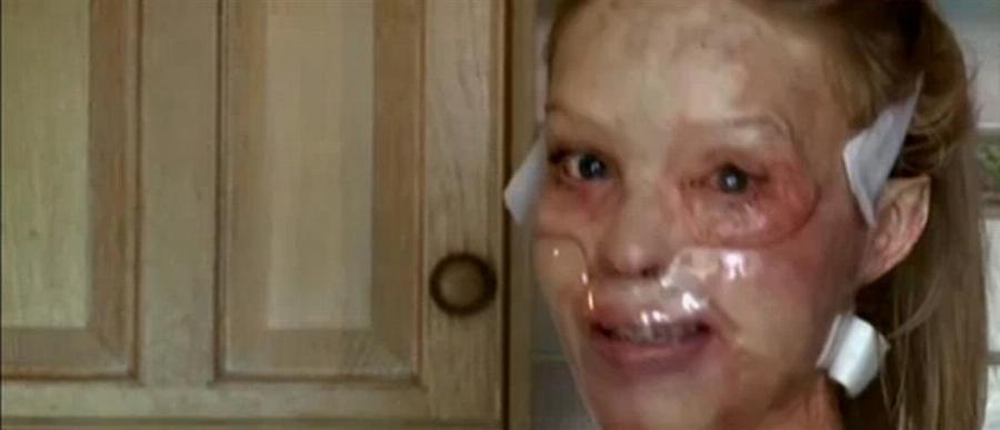 Οι ομοιότητες του «Γολγοθά» της Ιωάννας: Η επίθεση με οξύ στο μοντέλο από την Αγγλία Κέιτι Πάιπερ