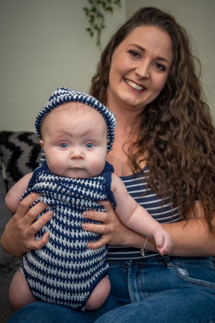 Μητέρα γνώριζε ότι θα γεννήσει παιδί χωρίς χέρι και πόδια και το κράτησε – Αρνήθηκε να αποβάλει το μωρό της