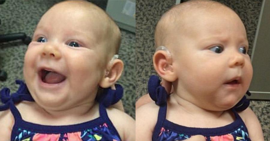 Χάρισαν ακοή σε 25 μωράκια με βαριά βαρηκοΐα στην κλινική του Αριστοτελείου Πανεπιστημίου Θεσσαλονίκης