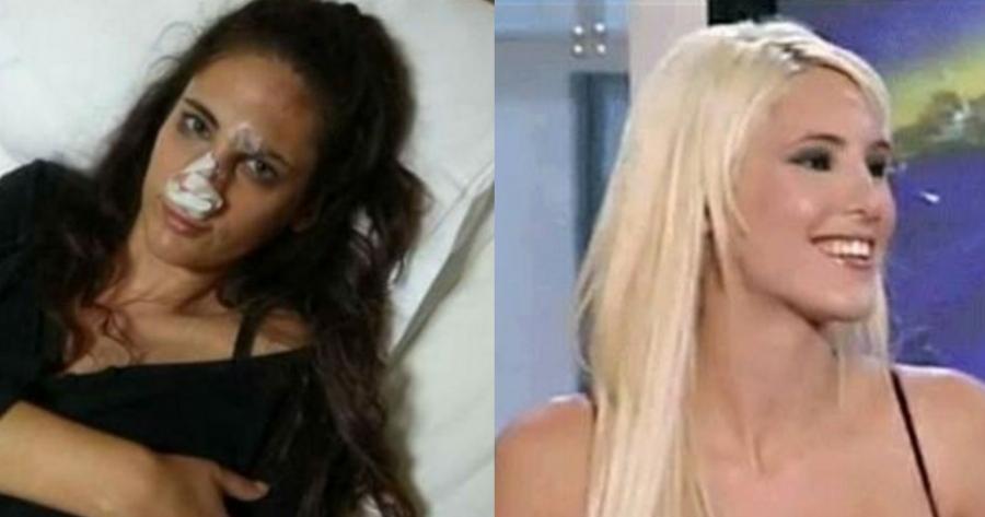 3ο χειρουργείο μετά από τον ξυλοδαρμό της για τη Ναστάζια, το αξέχαστο κορίτσι του Θέμου