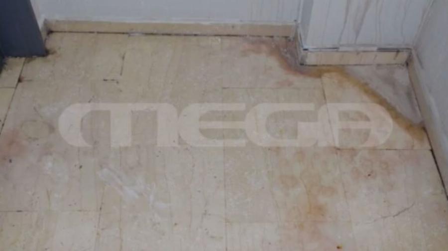 Εικόνα που κόβει την ανάσα: Η 35χρονη Ιωάννα αποκαλύπτει το πρόσωπο της μετά την επίθεση με το βιτριόλι