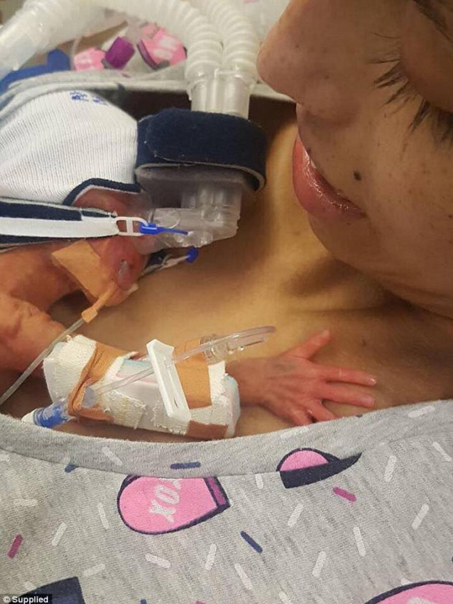 Διαγνώστηκε με επιθετική λευχαιμία και αποφάσισε να ζήσει το μωρό της και να πεθάνει η ίδια – Μόλις 18χρονών η έγκυος γυναίκα