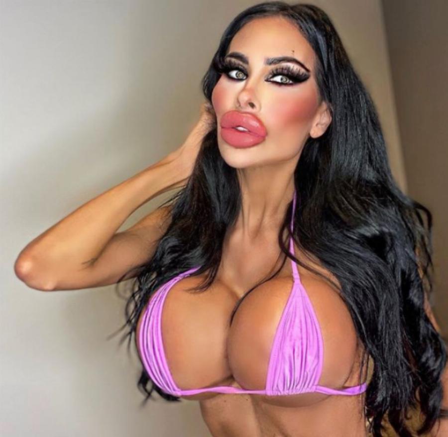 Νοσοκόμα 31 ετών εθισμένη στις πλαστικές: Γυρίζει τον κόσμο κάνοντας επεμβάσεις στο σώμα της