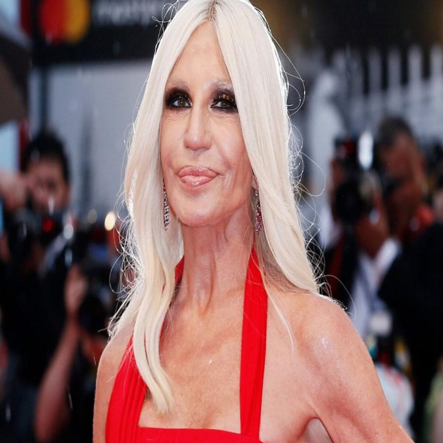 Έκαναν εγχειρήσεις αλλά τις μετάνιωσαν: 10 διάσημες που παραμορφώθηκαν από τις πλαστικές επεμβάσεις