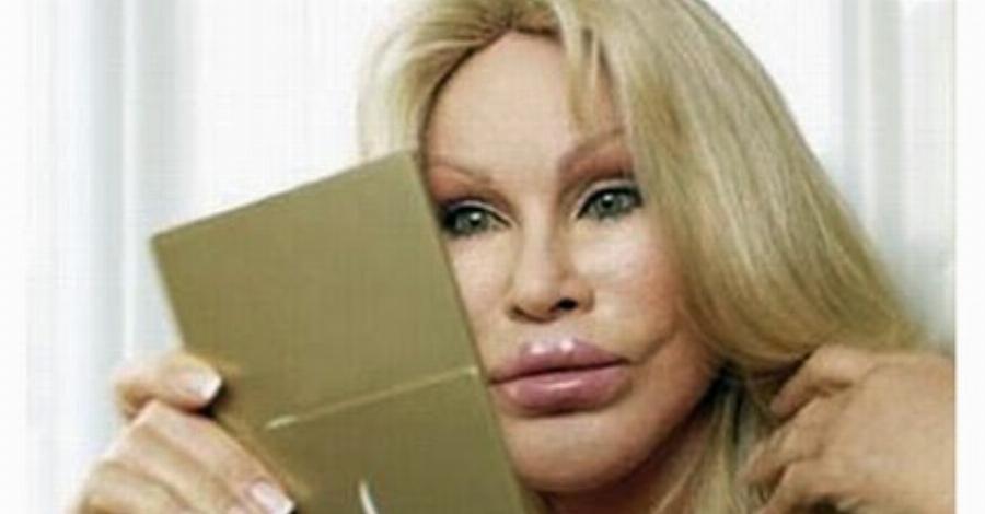 Έκαναν εγχειρήσεις αλλά τις μετάνιωσαν: 10 διάσημες που παραμορφώθηκαν από τις πλαστικές επεμβάσεις
