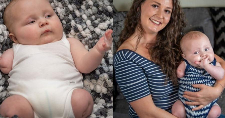 Μητέρα γνώριζε ότι θα γεννήσει παιδί χωρίς χέρι και πόδια και το κράτησε – Αρνήθηκε να αποβάλει το μωρό της