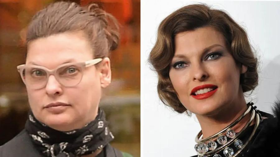 «Έγινα αυτό που τα media περιγράφουν “αγνώριστη”»: Παραμορφώθηκε η Λίντα Εβαντζελίστα από αισθητική επέμβαση