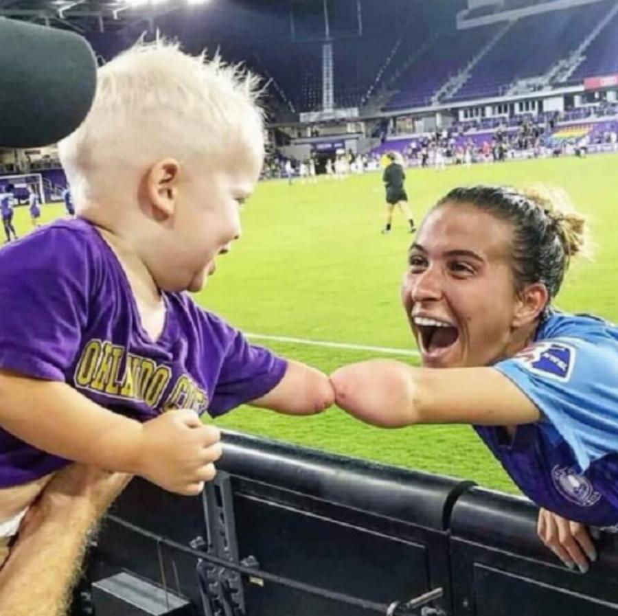 Η φωτογραφία με το πιο δυνατό μήνυμα: Αθλήτρια χωρίς χέρι συναντά μικρό αγόρι με την ίδια ιδιαιτερότητα