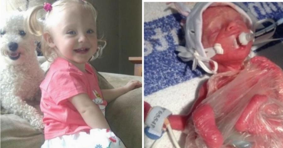 Μωράκι που γεννήθηκε πρόωρα μόλις 600gr, σήμερα γίνεται 5 ετών και πάει για πρώτη φορά στο σχολείο