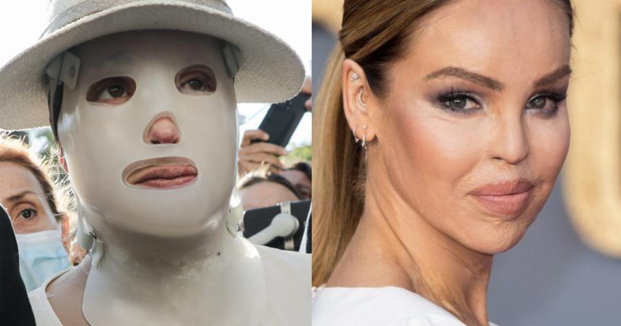 Οι ομοιότητες του «Γολγοθά» της Ιωάννας: Η επίθεση με οξύ στο μοντέλο από την Αγγλία Κέιτι Πάιπερ