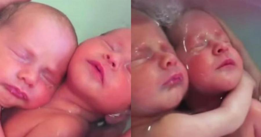 Δίδυμα μωράκια δεν έχουν καταλάβει ότι γεννήθηκαν και αγκαλιάζονται ακόμη όπως ήταν μέσα στην κοιλιά της μαμάς τους