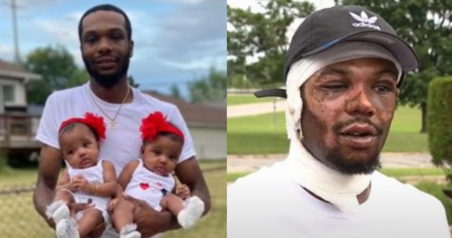 Πατέρας ρίχτηκε στις φλόγες για να σώσει τα δίδυμα κοριτσάκια του