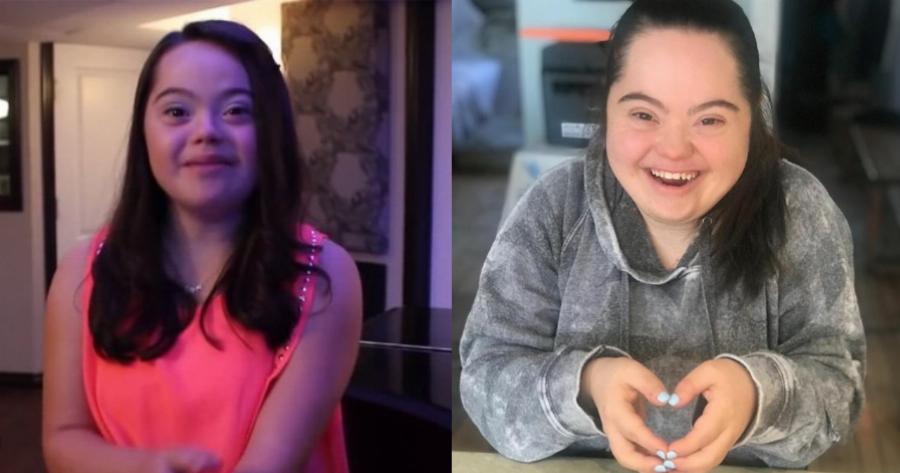 Φωνή που κόβει την ανάσα: Nεαρή κοπέλα με σύνδρομο Down τραγουδάει σαν άγγελος