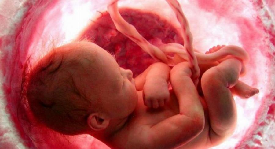 Έμβρυο μέσα στη μήτρα χειρουργήθηκε με επιτυχία στο νοσοκομείο Αττικόν, δίνοντας ελπίδα σε πολλές μανούλες