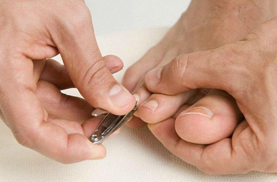 «O άντρας μου κόβει τα νύχια των ποδιών του και επειδή τα πετάει όπου βρει, εγώ τα ρίχνω στον καφέ του»