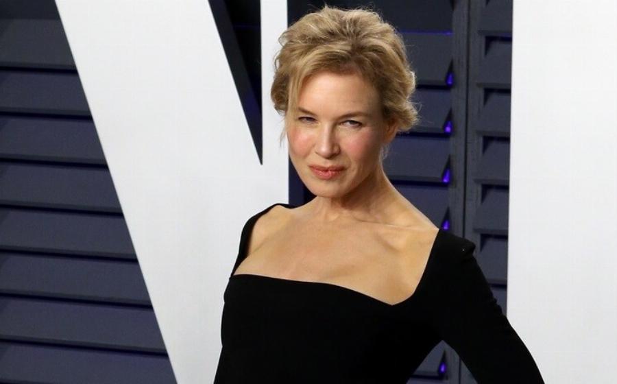 Έκαναν εγχειρήσεις αλλά τις μετάνιωσαν: 10 διάσημες που παραμορφώθηκαν από τις πλαστικές επεμβάσεις