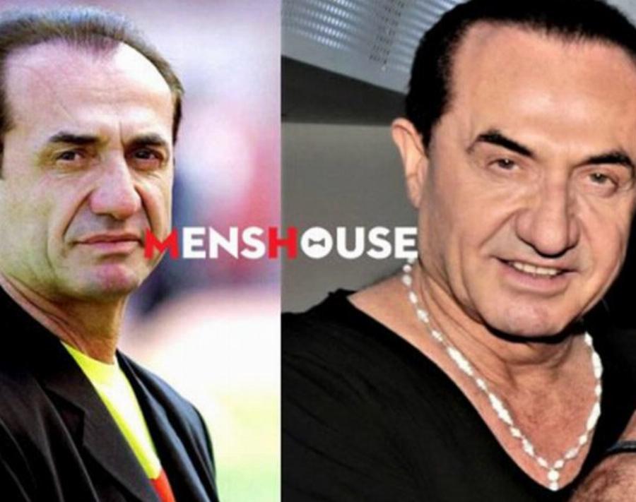 Οι 5 διάσημοι Έλληνες που τόλμησαν να κάνουν εμφύτευση μαλλιών