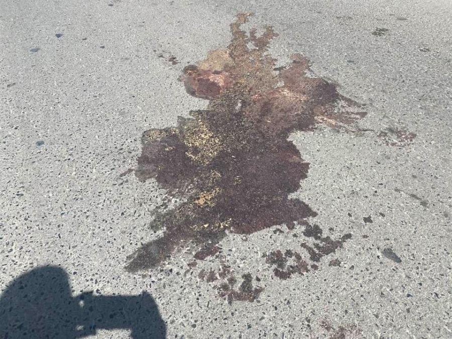 Ραγίζει και την πιο σκληρή καρδιά ο σπαραγμός της αδερφής του 20χρονου που έσβησε στην άσφαλτο