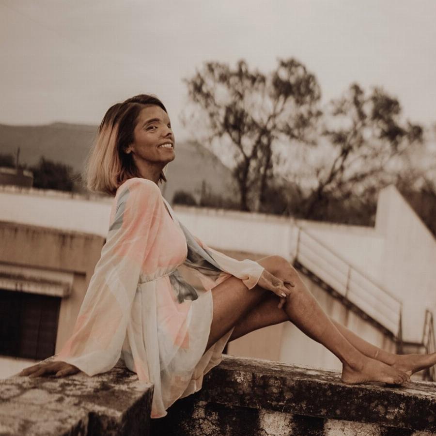 Δύο μηνών της έριξε οξύ στο πρόσωπο ο πατέρας της: Σήμερα είναι μοντέλο και εμπνέει τους πάντες