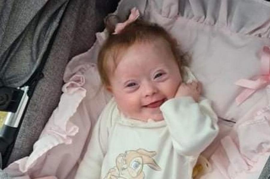 Νεογέννητο κοριτσάκι υποβλήθηκε σε επέμβαση καρδιάς, πέρασε 25 ώρες στην εντατική και βγήκε νικήτρια