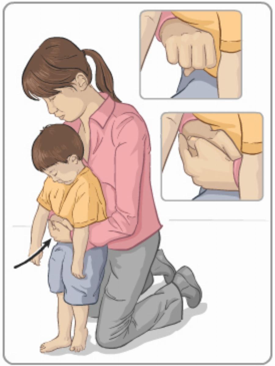 Οι οδηγίες πρώτων βοηθειών σε περίπτωση που πνίγεται ένα παιδί