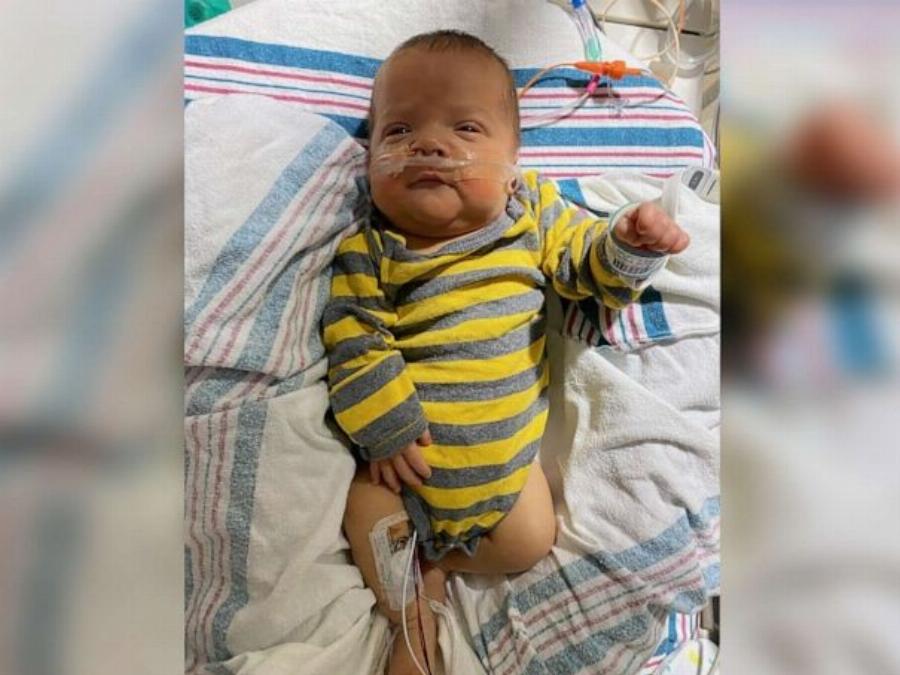 Θαύμα: Μωρό που γεννήθηκε πρόωρα πήγε για πρώτη φορά σπίτι του μετά από 136 μέρες στην εντατική