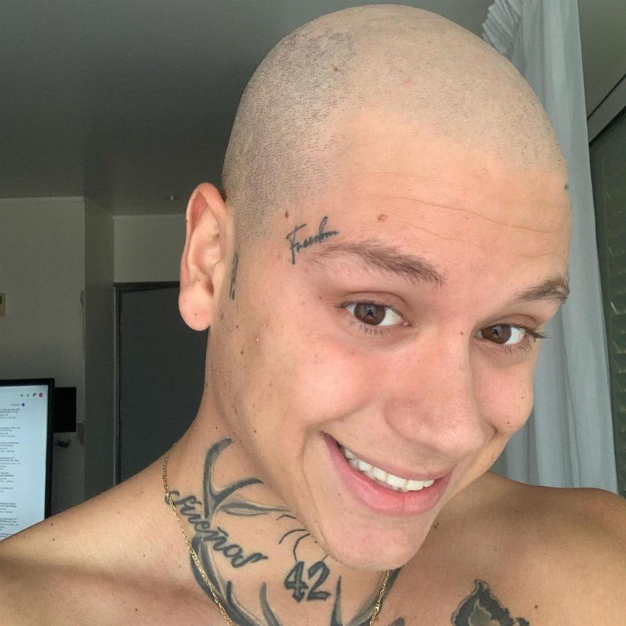 Καθαρός από τον καρκίνο ο Mike: Σήμερα κλείνει έναν χρόνο