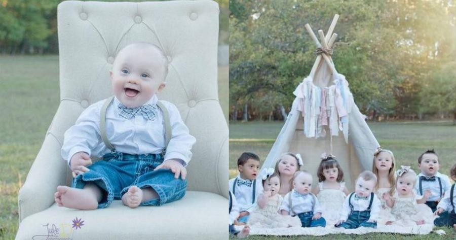 Συγκινητικές εικόνες: Γυναίκα φωτογραφίζει παιδιά με σύνδρομο Down για να αναδείξει την γλυκύτητα και την διαφορετικότητα τους