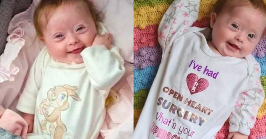 Νεογέννητο κοριτσάκι υποβλήθηκε σε επέμβαση καρδιάς, πέρασε 25 ώρες στην εντατική και βγήκε νικήτρια